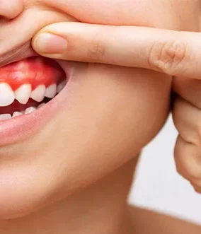 10 Possible Causes of Swollen Gums to Watch Out for