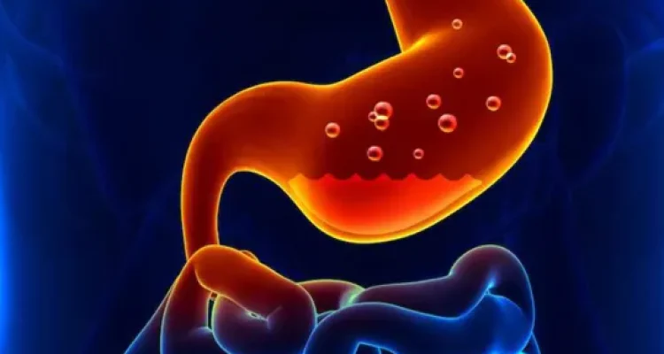 Don’t be trivial! Signs that your stomach has an ulcer