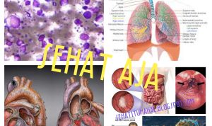 Penyakit Yang Tidak Terlihat Tetapi Berbahaya untuk Kesehatan