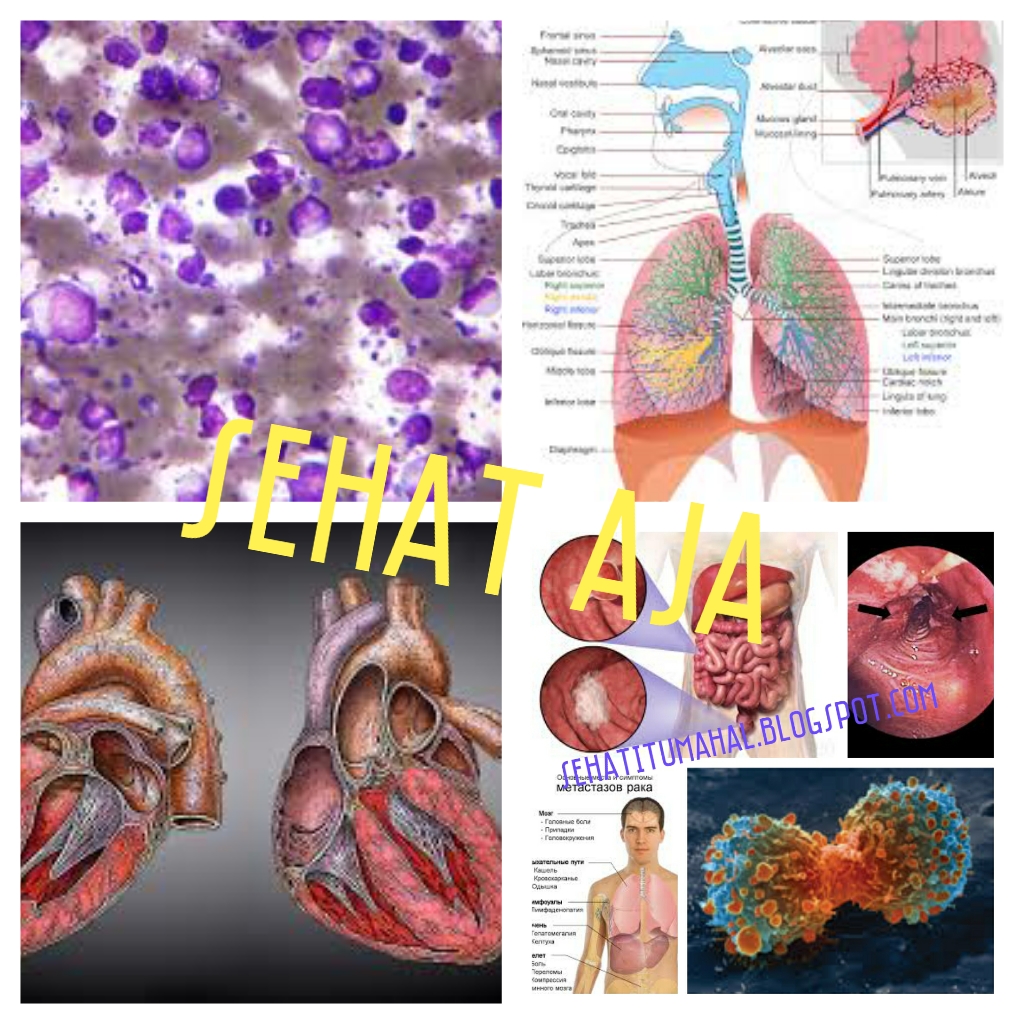Penyakit Yang Tidak Terlihat Tetapi Berbahaya untuk Kesehatan